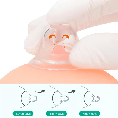 Roschic  Nipple Corrector
